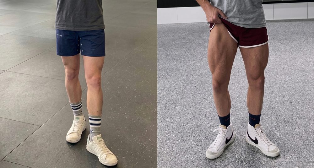 Nick Guthery’s legs before and after, side by side.
